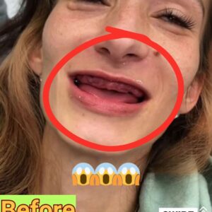 Ex drogadicto se transforma con un drástico cambio de sonrisa de 38.000 dólares Ex drogadicto se transforma con un drástico cambio de sonrisa de 38.000 dólares